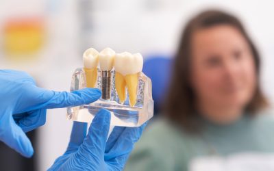 Abusive Habits and Dental Implants: Risk Factors and Long-Term Consequences